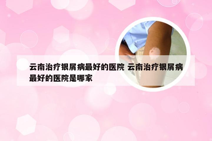 云南治疗银屑病最好的医院 云南治疗银屑病最好的医院是哪家