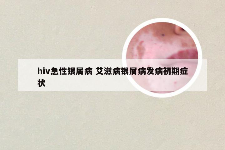 hiv急性银屑病 艾滋病银屑病发病初期症状