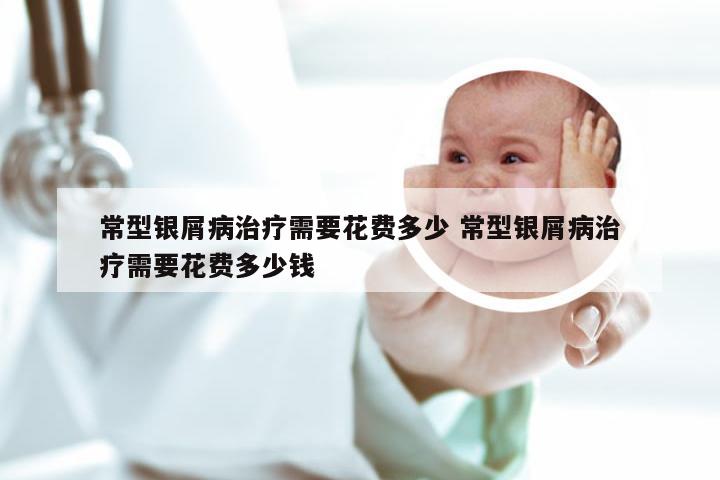 常型银屑病治疗需要花费多少 常型银屑病治疗需要花费多少钱