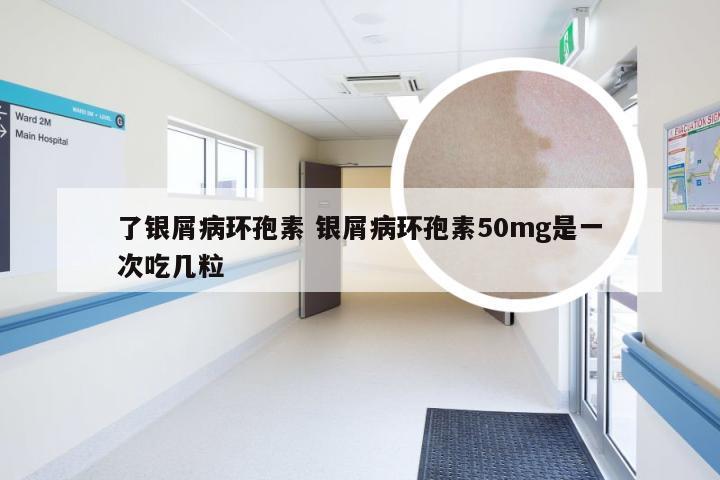 了银屑病环孢素 银屑病环孢素50mg是一次吃几粒