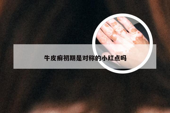 牛皮癣初期是对称的小红点吗