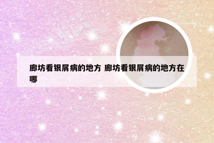 廊坊看银屑病的地方 廊坊看银屑病的地方在哪
