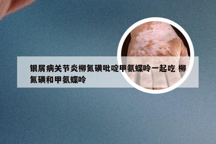 银屑病关节炎柳氮磺吡啶甲氨蝶呤一起吃 柳氮磺和甲氨蝶呤