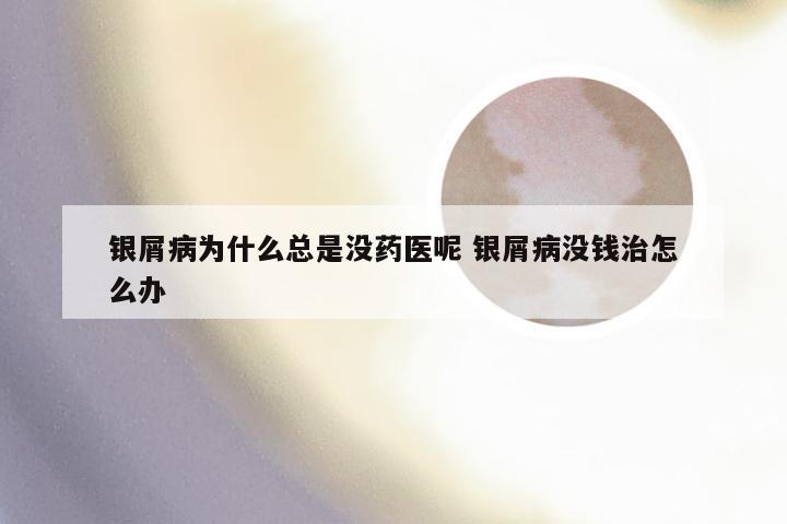银屑病为什么总是没药医呢 银屑病没钱治怎么办