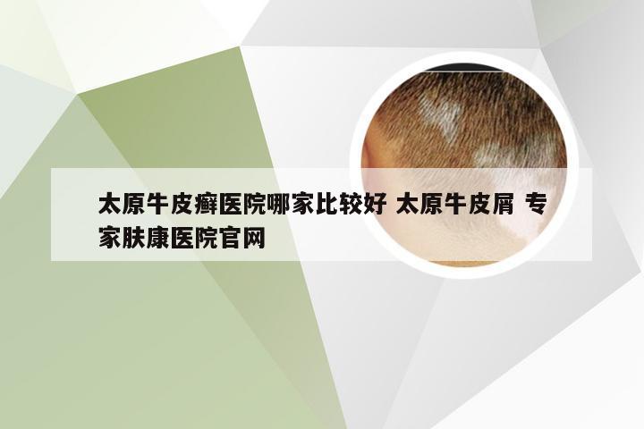 太原牛皮癣医院哪家比较好 太原牛皮屑 专家肤康医院官网