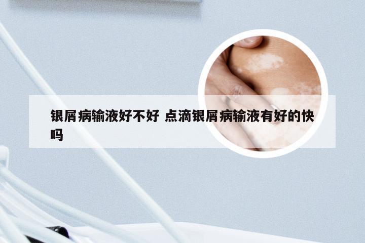 银屑病输液好不好 点滴银屑病输液有好的快吗