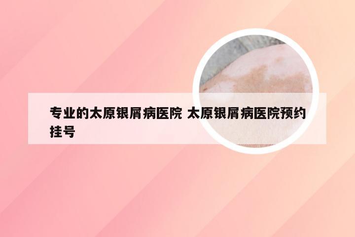 专业的太原银屑病医院 太原银屑病医院预约挂号