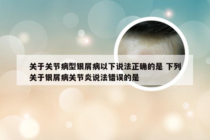 关于关节病型银屑病以下说法正确的是 下列关于银屑病关节炎说法错误的是