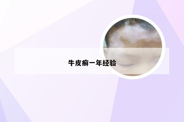 牛皮癣一年经验