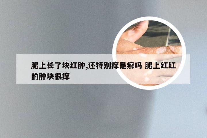腿上长了块红肿,还特别痒是癣吗 腿上红红的肿块很痒