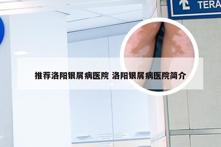 推荐洛阳银屑病医院 洛阳银屑病医院简介