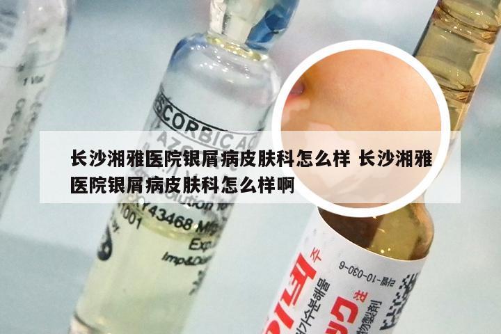 长沙湘雅医院银屑病皮肤科怎么样 长沙湘雅医院银屑病皮肤科怎么样啊