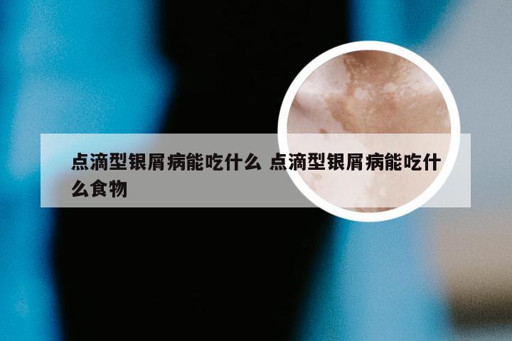 点滴型银屑病能吃什么 点滴型银屑病能吃什么食物