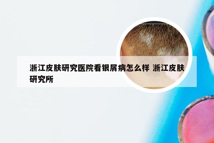 浙江皮肤研究医院看银屑病怎么样 浙江皮肤研究所
