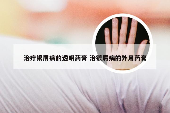 治疗银屑病的透明药膏 治银屑病的外用药膏