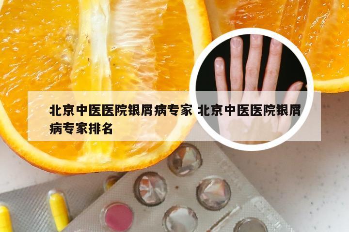 北京中医医院银屑病专家 北京中医医院银屑病专家排名