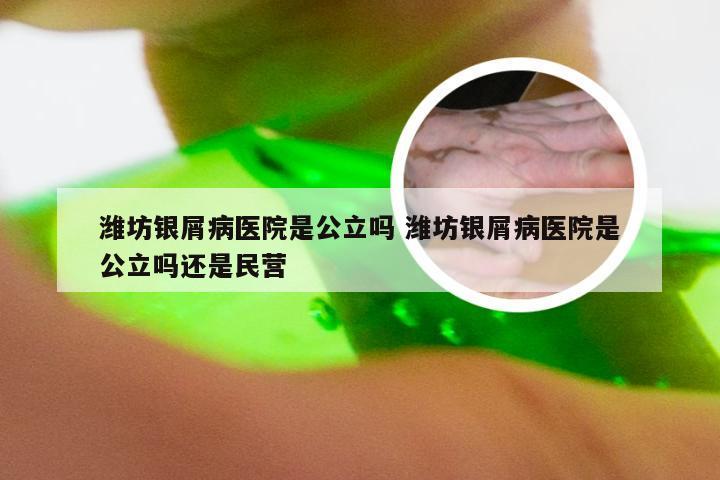 潍坊银屑病医院是公立吗 潍坊银屑病医院是公立吗还是民营
