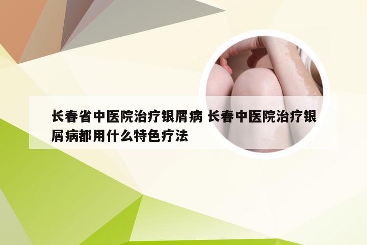 长春省中医院治疗银屑病 长春中医院治疗银屑病都用什么特色疗法