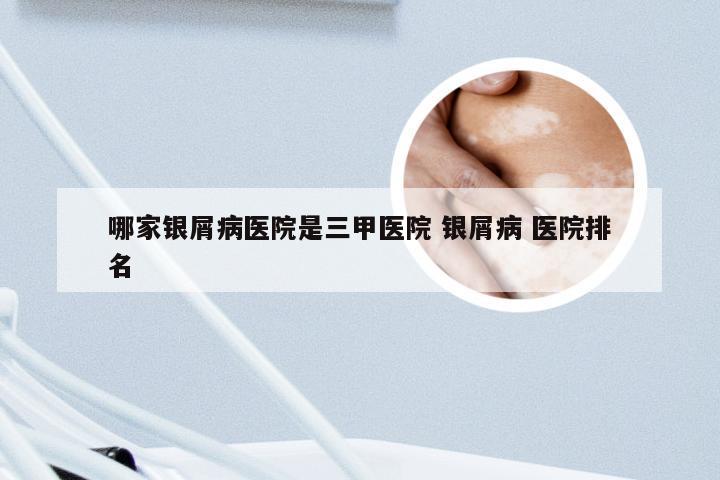 哪家银屑病医院是三甲医院 银屑病 医院排名