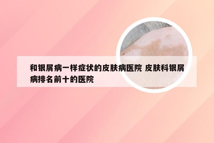 和银屑病一样症状的皮肤病医院 皮肤科银屑病排名前十的医院