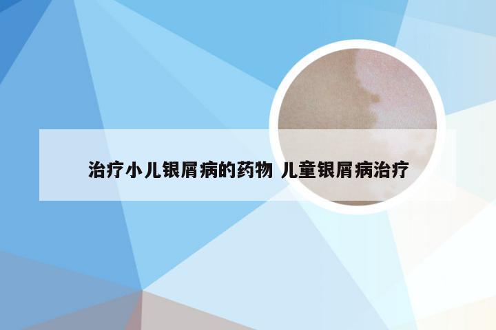 治疗小儿银屑病的药物 儿童银屑病治疗