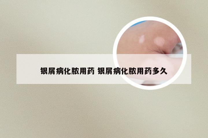 银屑病化脓用药 银屑病化脓用药多久