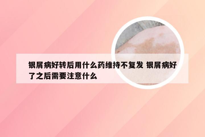 银屑病好转后用什么药维持不复发 银屑病好了之后需要注意什么