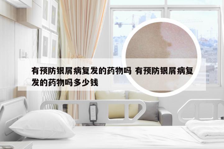 有预防银屑病复发的药物吗 有预防银屑病复发的药物吗多少钱