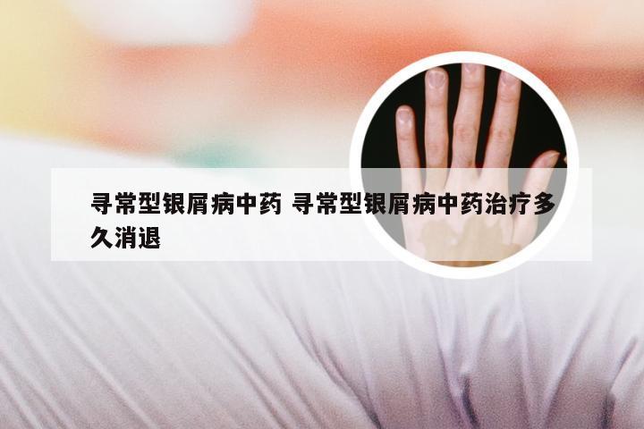 寻常型银屑病中药 寻常型银屑病中药治疗多久消退