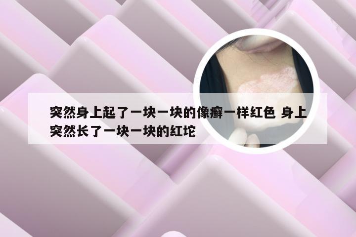 突然身上起了一块一块的像癣一样红色 身上突然长了一块一块的红坨