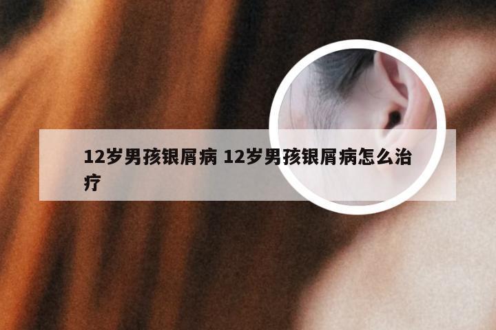 12岁男孩银屑病 12岁男孩银屑病怎么治疗