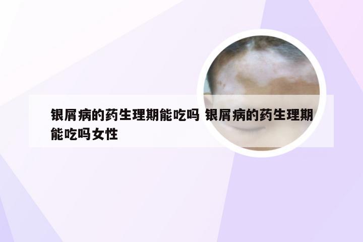 银屑病的药生理期能吃吗 银屑病的药生理期能吃吗女性