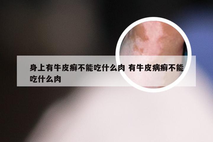 身上有牛皮癣不能吃什么肉 有牛皮病癣不能吃什么肉