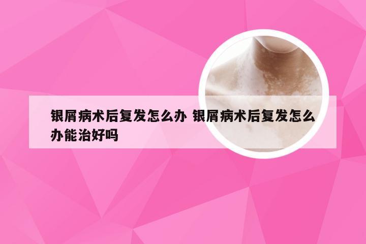 银屑病术后复发怎么办 银屑病术后复发怎么办能治好吗