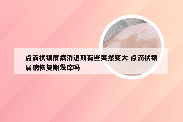 点滴状银屑病消退期有些突然变大 点滴状银屑病恢复期发痒吗