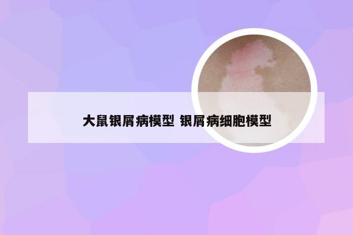 大鼠银屑病模型 银屑病细胞模型