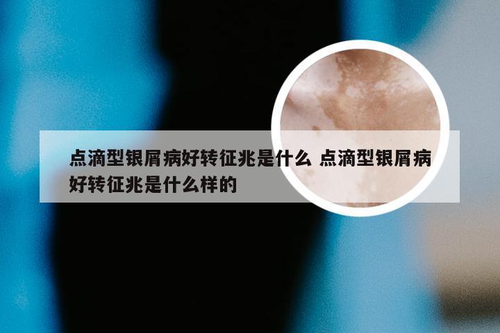 点滴型银屑病好转征兆是什么 点滴型银屑病好转征兆是什么样的