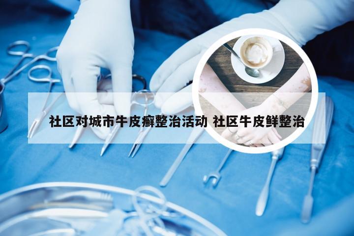 社区对城市牛皮癣整治活动 社区牛皮鲜整治