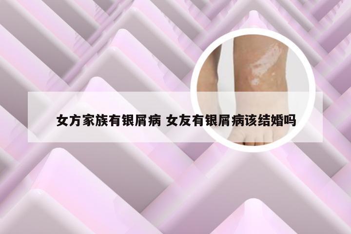 女方家族有银屑病 女友有银屑病该结婚吗
