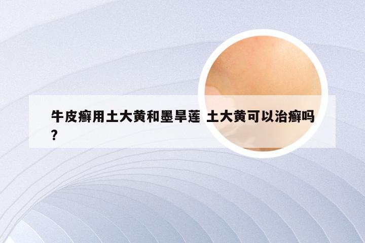 牛皮癣用土大黄和墨旱莲 土大黄可以治癣吗?