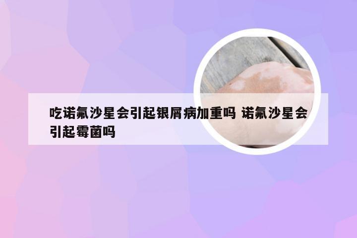 吃诺氟沙星会引起银屑病加重吗 诺氟沙星会引起霉菌吗