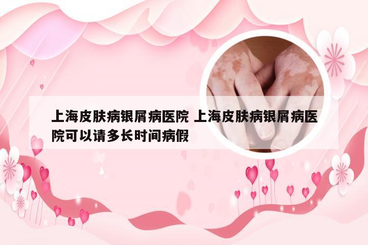 上海皮肤病银屑病医院 上海皮肤病银屑病医院可以请多长时间病假