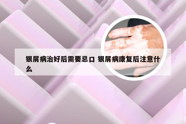 银屑病治好后需要忌口 银屑病康复后注意什么