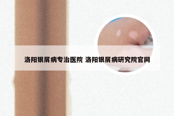 洛阳银屑病专治医院 洛阳银屑病研究院官网