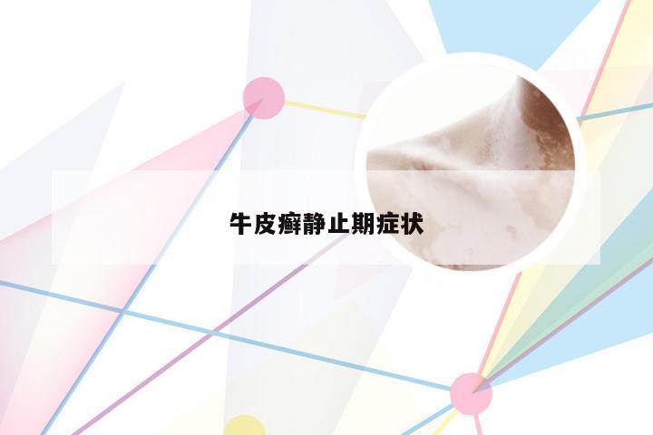 牛皮癣静止期症状