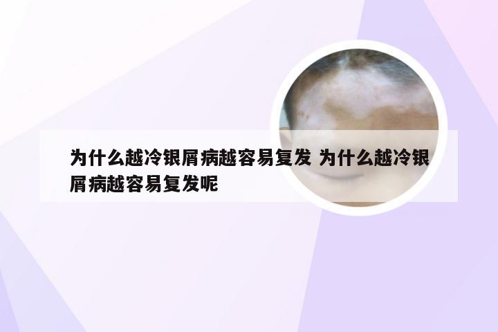 为什么越冷银屑病越容易复发 为什么越冷银屑病越容易复发呢