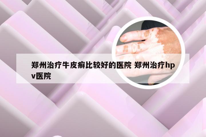 郑州治疗牛皮癣比较好的医院 郑州治疗hpv医院