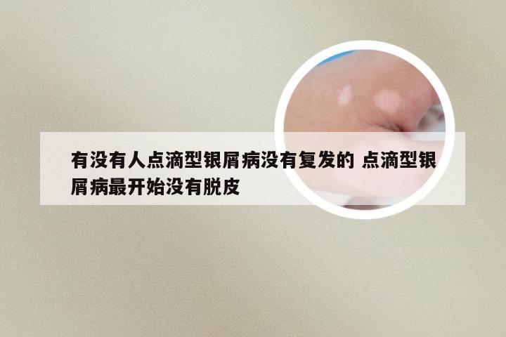 有没有人点滴型银屑病没有复发的 点滴型银屑病最开始没有脱皮