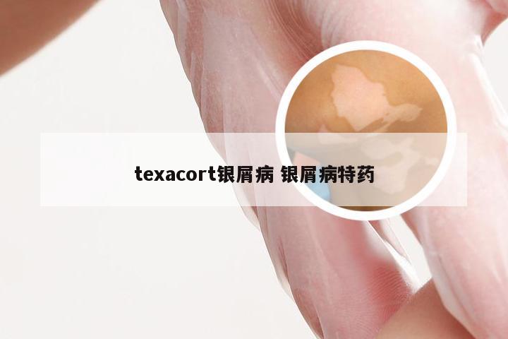 texacort银屑病 银屑病特药