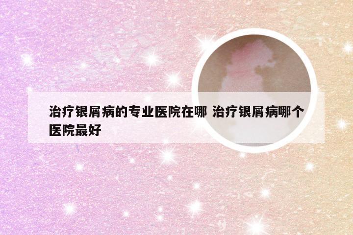 治疗银屑病的专业医院在哪 治疗银屑病哪个医院最好